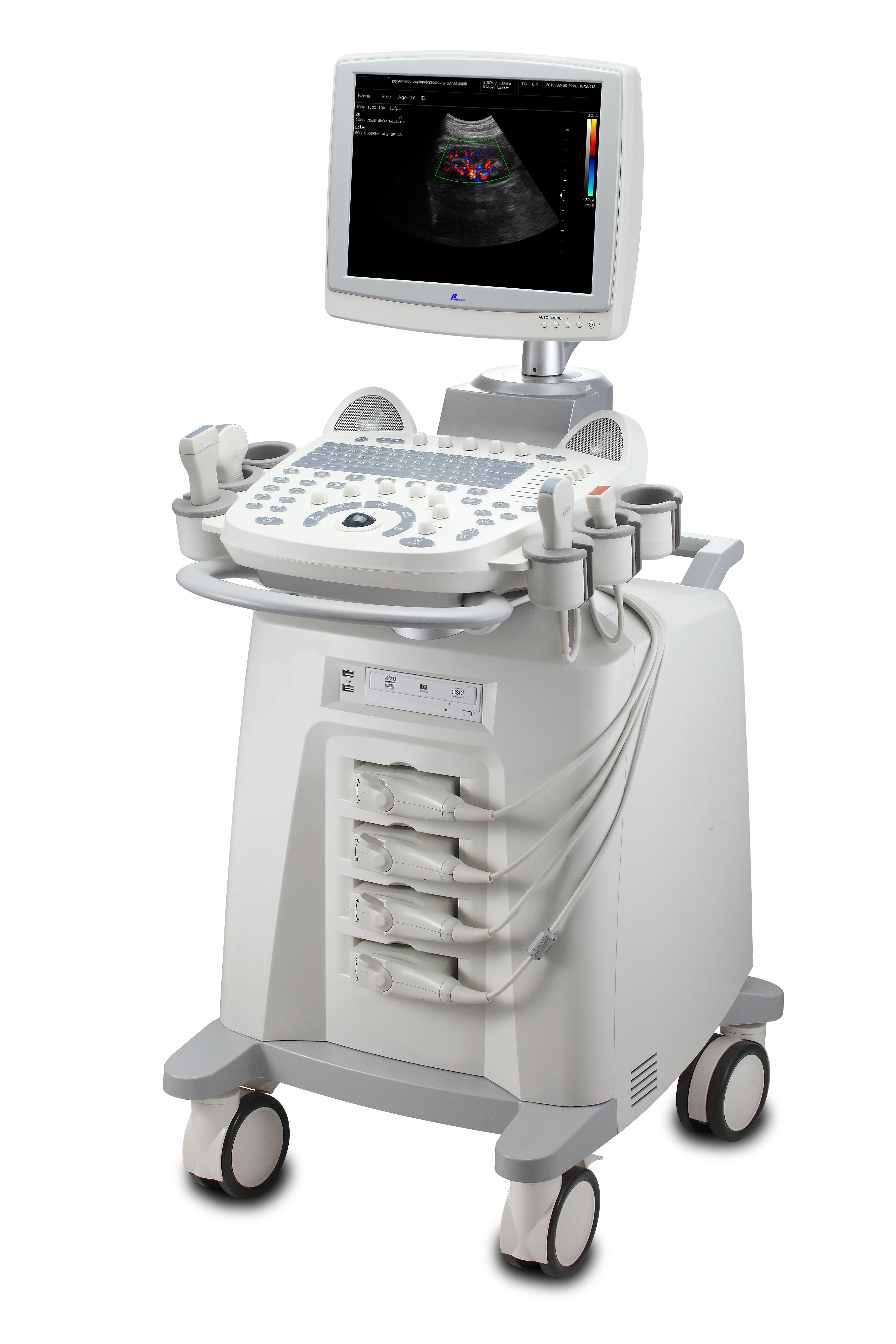 医院医疗便携式和移动 Sonoscape 4D 彩色多普勒