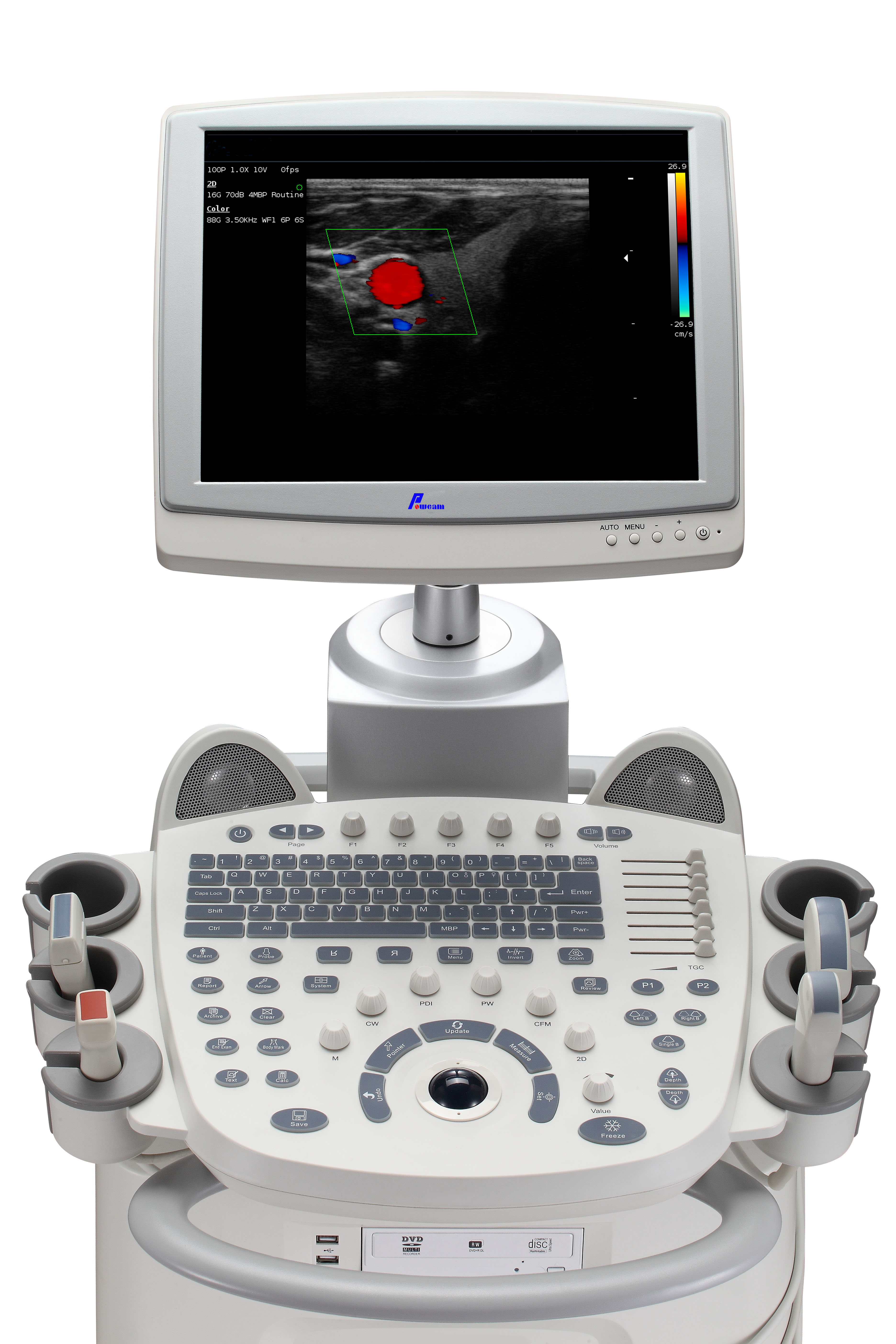 医院医疗便携式和移动 Sonoscape 4D 彩色多普勒